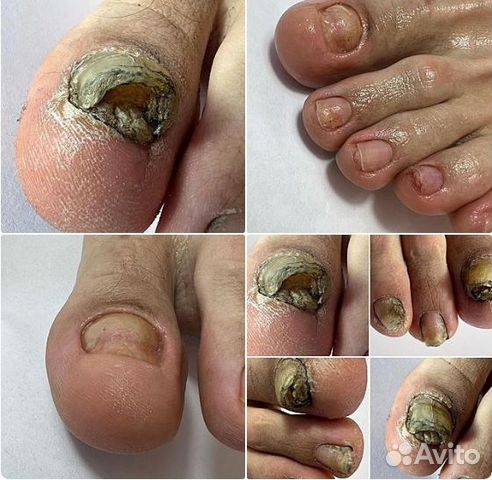 Услуги подолога